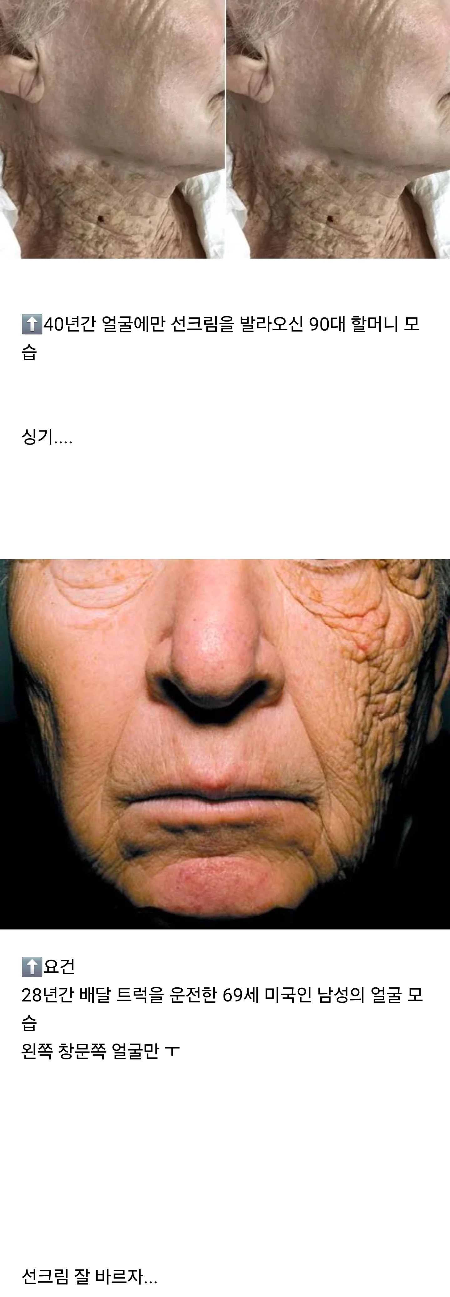 40년간 선크림을 꾸준히 '얼굴 에만' 바르신 할머니